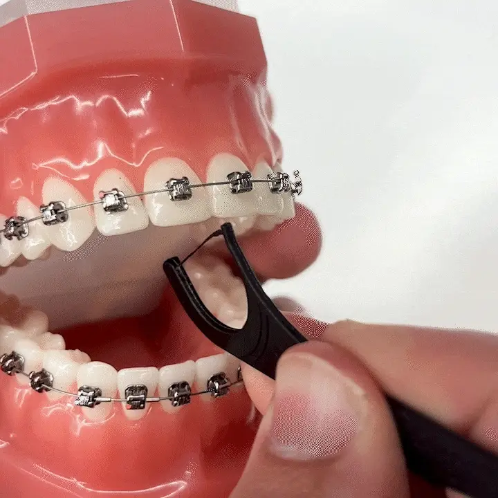 Braces Floss Picks - Image 5